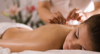 An acupuncturist inserts needles into a woman's back.